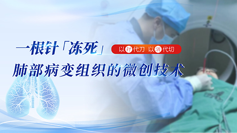 冷冻消融术一根针”治疗肺结节